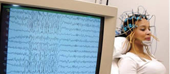 Electroencephalogram
