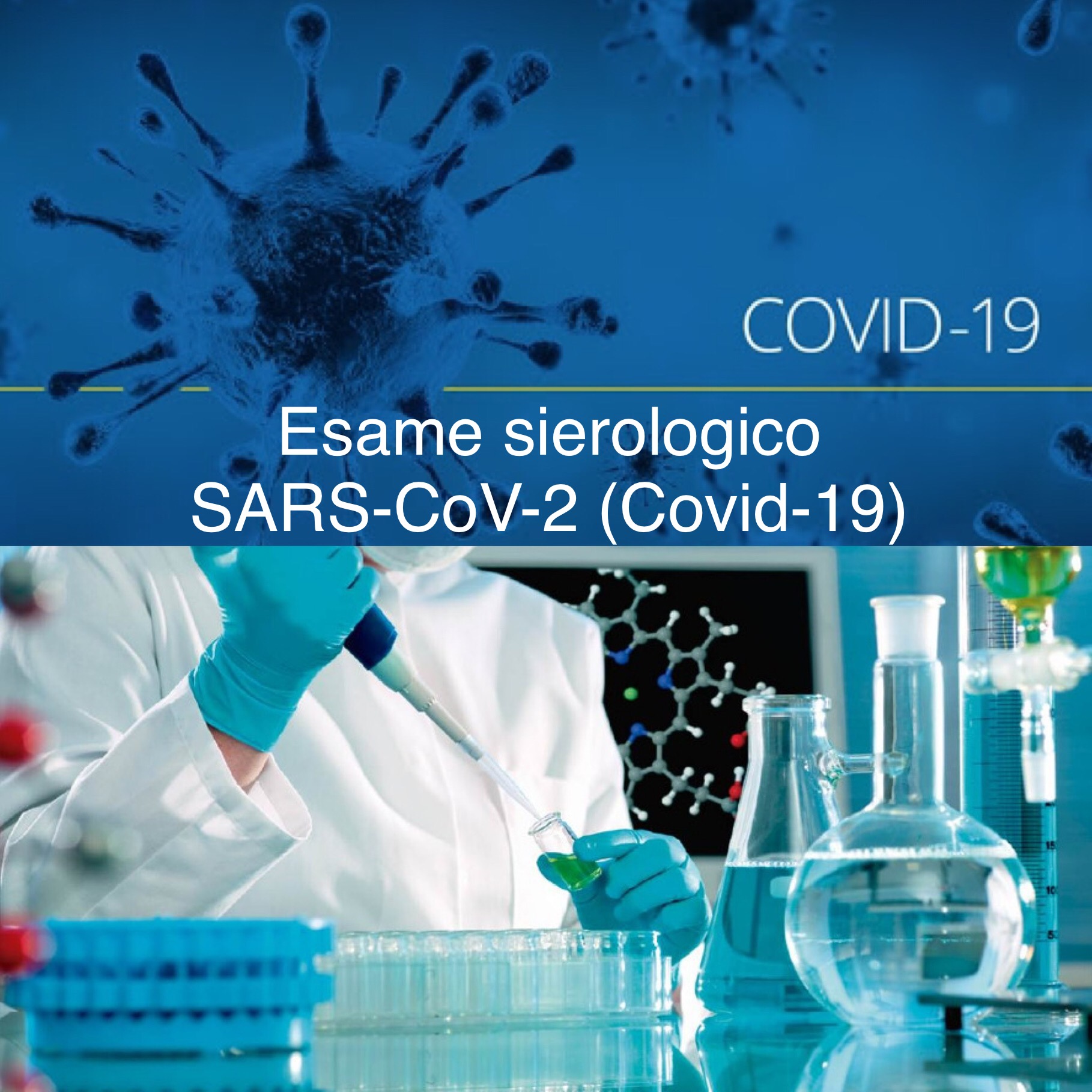 Esame sierologico SARS-Cov-2